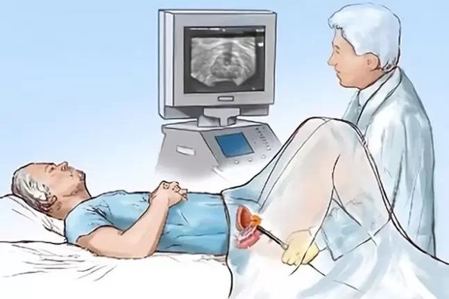 Diagnos vun Prostatitis